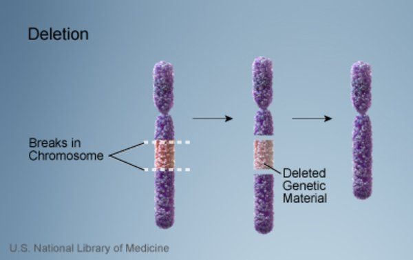 best of Faulty in prader Sperm