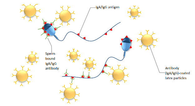 Dragon reccomend Anit sperm antibody