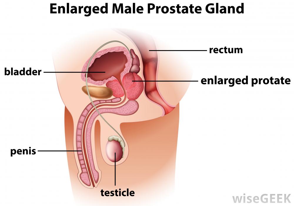 best of Pics Prostate orgasm