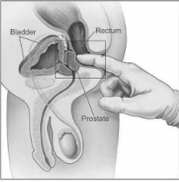 Violent vomiting leading to facial brusing