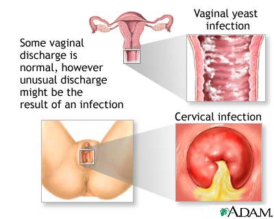 Funnel C. reccomend Vagina burns after alot of sex