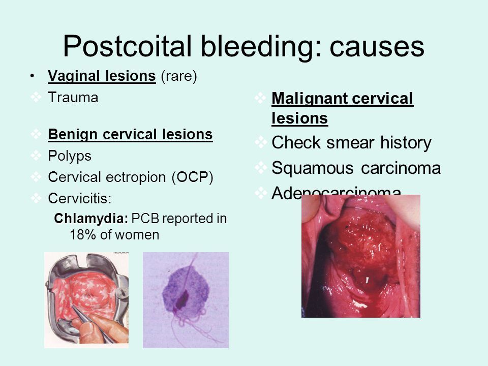 Bleeding sex trauma vaginal