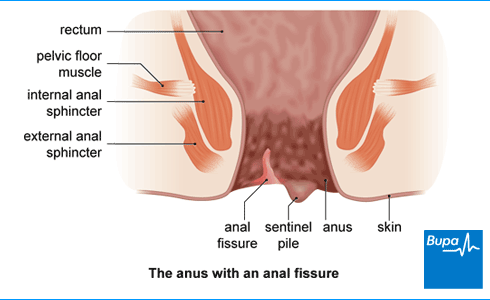 Clip clit information