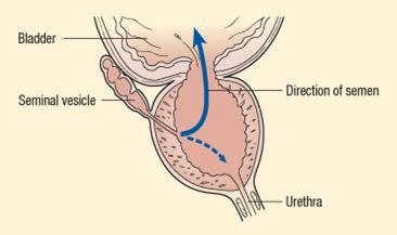 best of Orgasm Prostatic fluid no