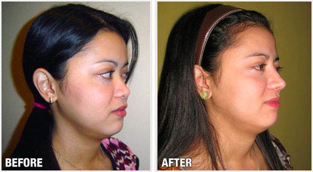 Wild R. reccomend Chicago facial amp body plastic surgery frederick