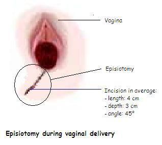 Vagina wetness during sex