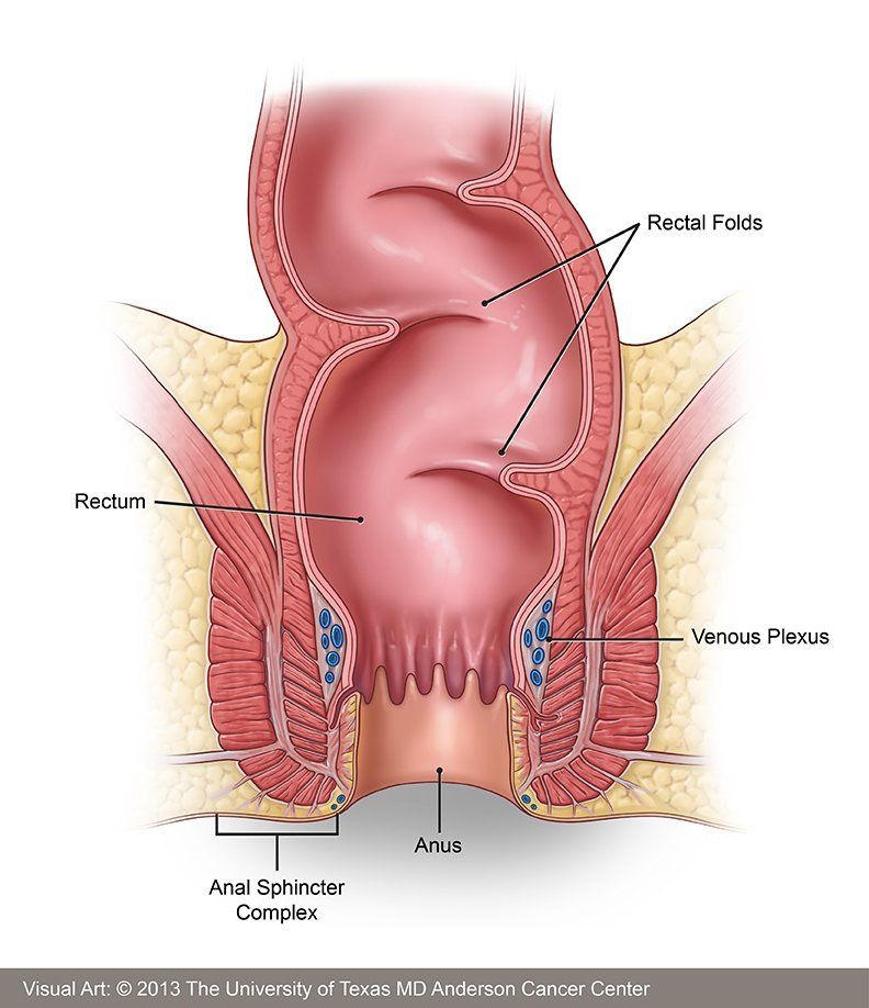 Gully reccomend Anal rectal carcinoma