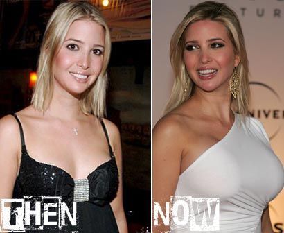 Boob ivanka job trump