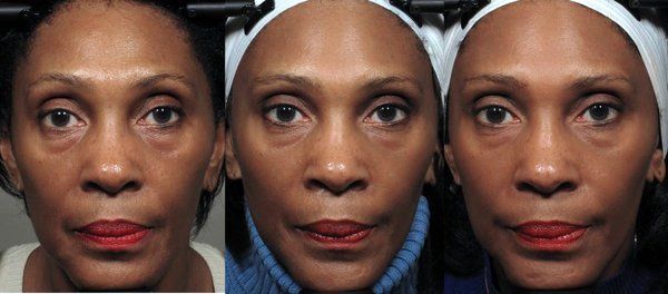 best of Exercises pics Facial