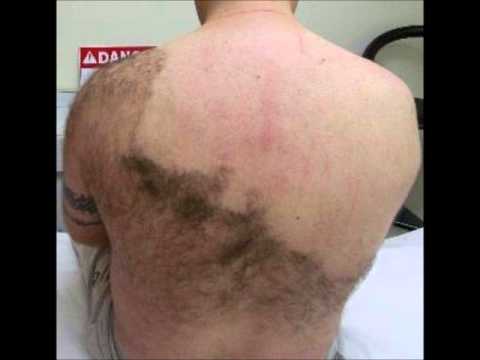 Hairy man with 3 shaved in back