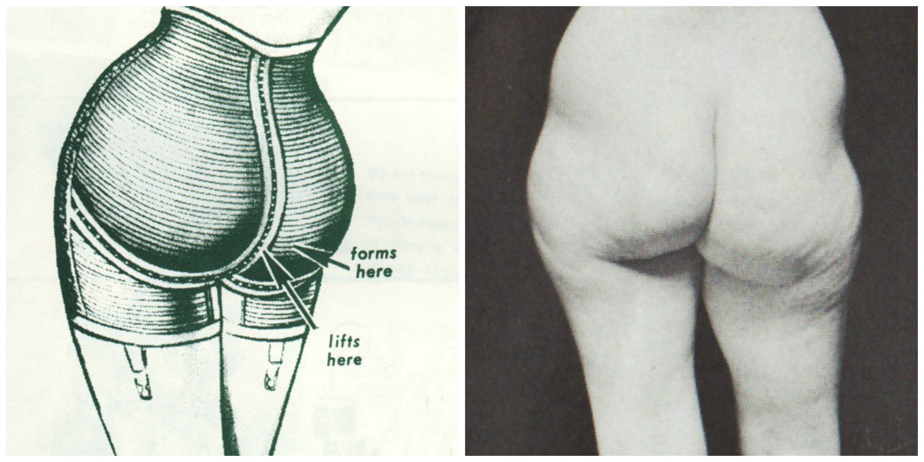 Sex butt forms