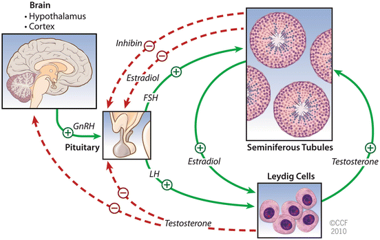 best of Faulty in prader Sperm