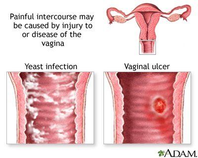 best of Alot sex Vagina burns after of