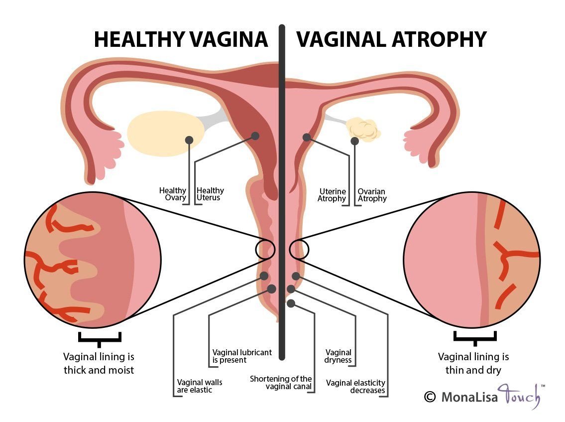 Vagina vulva pics