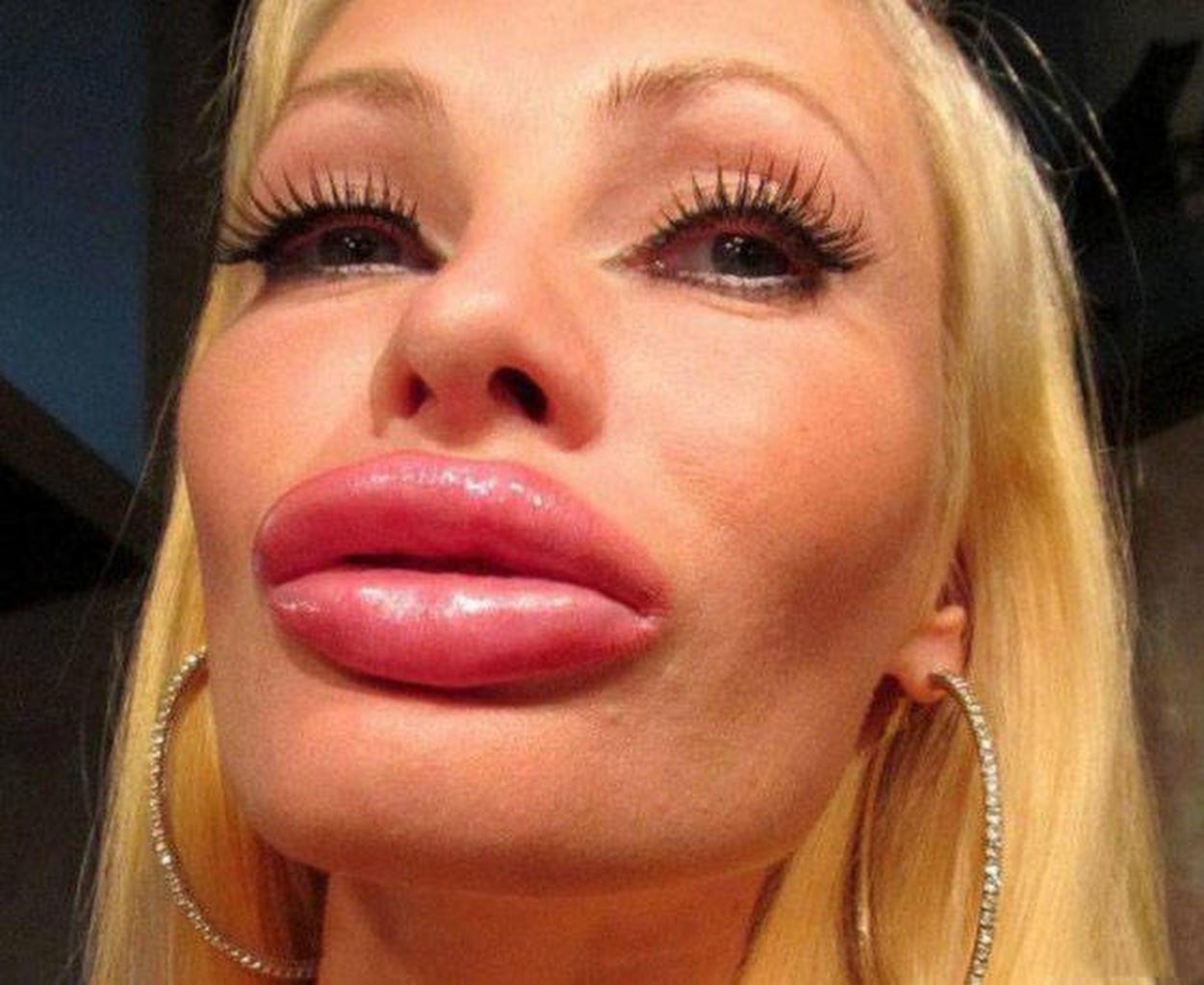 Giant lips