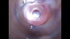 Speculum orgasm contractions